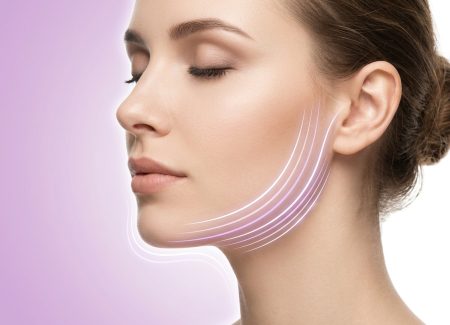 فرم صورت کشیده و خط فک مشخص پس از مزو چربی‌سوز